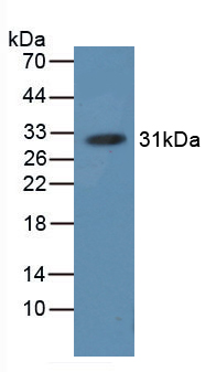 Polyclonal Antibody to Hemoglobin (HB)