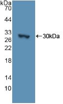 Polyclonal Antibody to Adenylate Cyclase 3 (ADCY3)