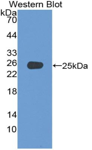 Polyclonal Antibody to Adenylate Cyclase 4 (ADCY4)