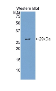 Polyclonal Antibody to Glucuronidase Beta (GUSb)