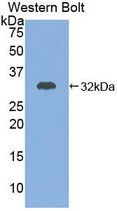 Polyclonal Antibody to Adenylate Cyclase 7 (ADCY7)