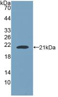 Polyclonal Antibody to Nuclear Pore Glycoprotein 210 (gp210)