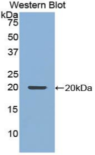 Polyclonal Antibody to Nuclear Pore Glycoprotein 210 (gp210)