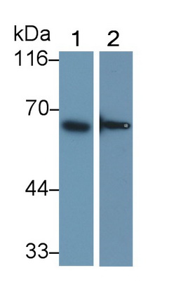 Polyclonal Antibody to Interferon Alpha/Beta Receptor 1 (IFNa/bR1)