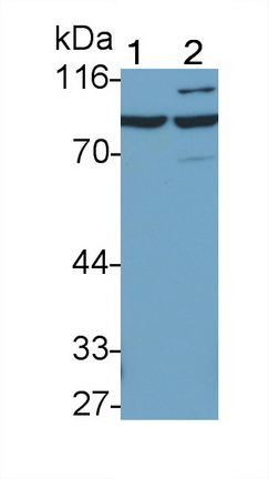 Polyclonal Antibody to Interferon Alpha/Beta Receptor 1 (IFNa/bR1)