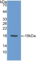 Polyclonal Antibody to Cluster Of Differentiation 99 (CD99)