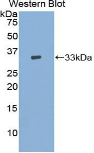 Polyclonal Antibody to Adenylate Cyclase 9 (ADCY9)