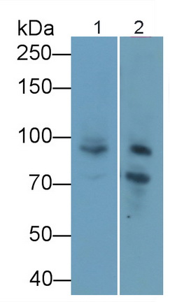 Polyclonal Antibody to Semaphorin 4D (SEMA4D)