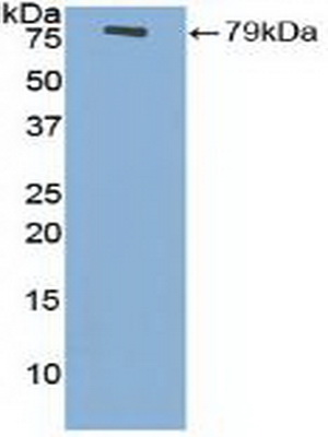 Polyclonal Antibody to Enolase 3 (ENO3)