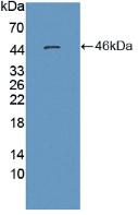 Polyclonal Antibody to Enolase 3 (ENO3)