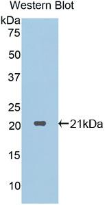 Polyclonal Antibody to Proteinase 3 (PR3)