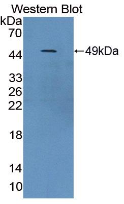 Polyclonal Antibody to Tyrosine Hydroxylase (TH)