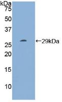 Polyclonal Antibody to Ribonuclease Inhibitor (RI)