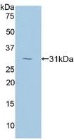 Polyclonal Antibody to Ribonuclease Inhibitor (RI)