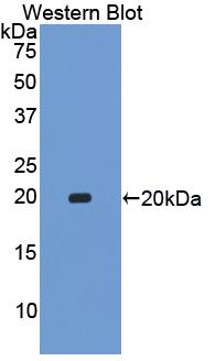 Polyclonal Antibody to Acetylcholinesterase (ACHE)