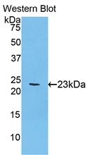 Polyclonal Antibody to Acetylcholinesterase (ACHE)