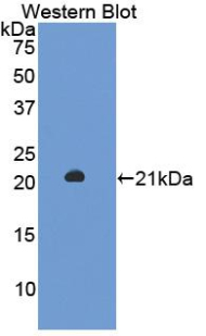 Polyclonal Antibody to Enolase 1 (ENO1)