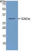 Polyclonal Antibody to Amylase, Alpha 2A (AMY2A)