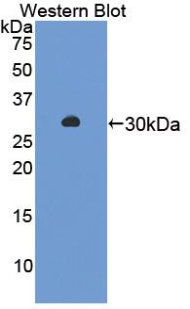 Polyclonal Antibody to Amylase, Alpha 2A (AMY2A)