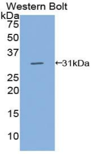 Polyclonal Antibody to Cluster Of Differentiation 109 (CD109)