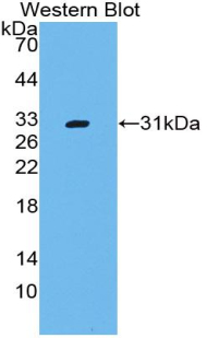 Polyclonal Antibody to Cluster Of Differentiation 109 (CD109)