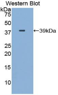 Polyclonal Antibody to Gamma-Lipotropic Hormone (gLPH)