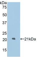 Polyclonal Antibody to Lysosomal Associated Membrane Protein 2 (LAMP2)