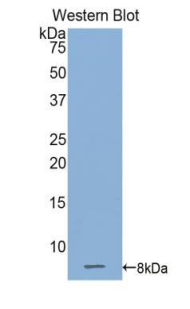 Polyclonal Antibody to Connexin 31 (CX31)