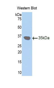 Polyclonal Antibody to Connexin 31 (CX31)