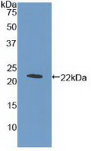 Polyclonal Antibody to Thrombopoietin Receptor (TPOR)