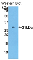 Polyclonal Antibody to Pitrilysin Metalloproteinase 1 (MP1)