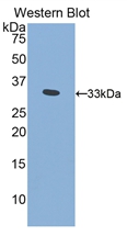 Polyclonal Antibody to Pitrilysin Metalloproteinase 1 (MP1)