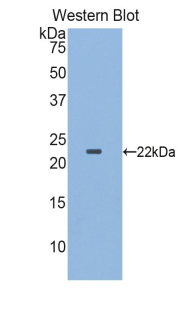 Polyclonal Antibody to Colony Stimulating Factor Receptor, Granulocyte (GCSFR)