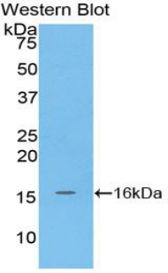 Polyclonal Antibody to Matrix Gla Protein (MGP)