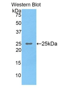 Polyclonal Antibody to Osteoclast Stimulating Factor 1 (OSF)