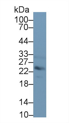 Polyclonal Antibody to Mannose Binding Lectin (MBL)