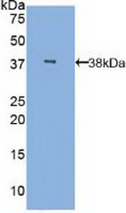 Polyclonal Antibody to Mannose Binding Lectin (MBL)