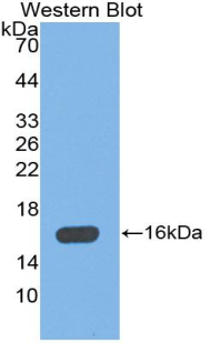 Polyclonal Antibody to Mannose Binding Lectin (MBL)