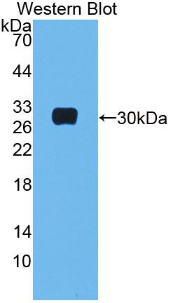 Polyclonal Antibody to Mannose Binding Lectin (MBL)