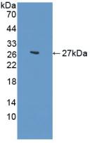 Polyclonal Antibody to N-cadherin (NCAD)