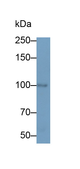 Polyclonal Antibody to N-cadherin (NCAD)