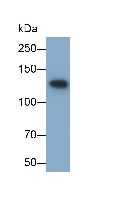 Polyclonal Antibody to N-cadherin (NCAD)