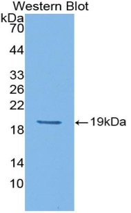 Polyclonal Antibody to Colony Stimulating Factor Receptor, Macrophage (MCSFR)