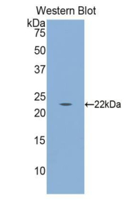 Polyclonal Antibody to Calreticulin (CALR)