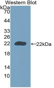 Polyclonal Antibody to Calreticulin (CALR)