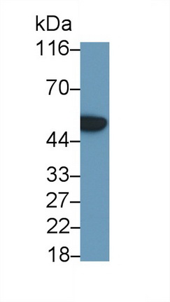 Polyclonal Antibody to Colony Stimulating Factor 2 Receptor Alpha (CSF2Ra)