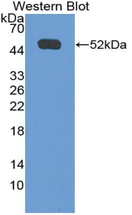 Polyclonal Antibody to Interferon Gamma Receptor 1 (IFNgR1)