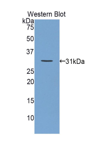 Polyclonal Antibody to Ornithine Transcarbamylase (OTC)