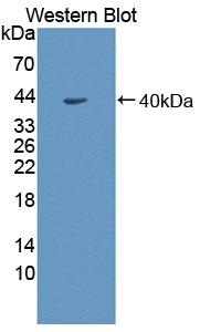 Polyclonal Antibody to Sorbitol Dehydrogenase (SDH)