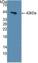 Polyclonal Antibody to Sorbitol Dehydrogenase (SDH)